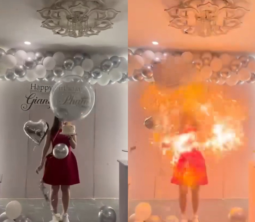 Hình ảnh trước và sau khi quả bóng bay phát nổ khiến nữ chính của buổi tiệc sinh nhật bị bỏng Hình ảnh trước và sau khi quả bóng bay phát nổ khiến nữ chính của buổi tiệc sinh nhật bị bỏng