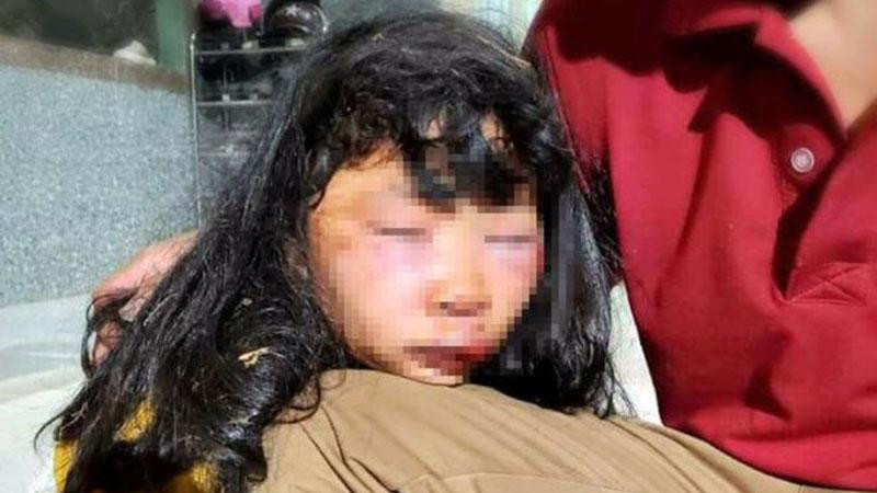 Bị tấn công bất ngờ khiến nạn nhân không kịp phản ứng cũng như kêu cứu (Ảnh: Nguyễn Long)