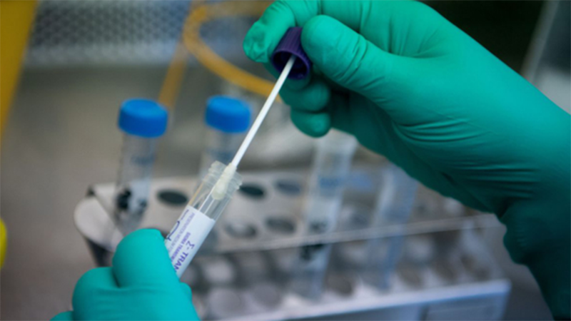 Phải trải qua rất nhiều các xét nghiệm khác nhau, bệnh nhân nhiễm Covid-19 mới được công nhận khỏi bệnh Phải trải qua rất nhiều các xét nghiệm khác nhau, bệnh nhân nhiễm Covid-19 mới được công nhận khỏi bệnh