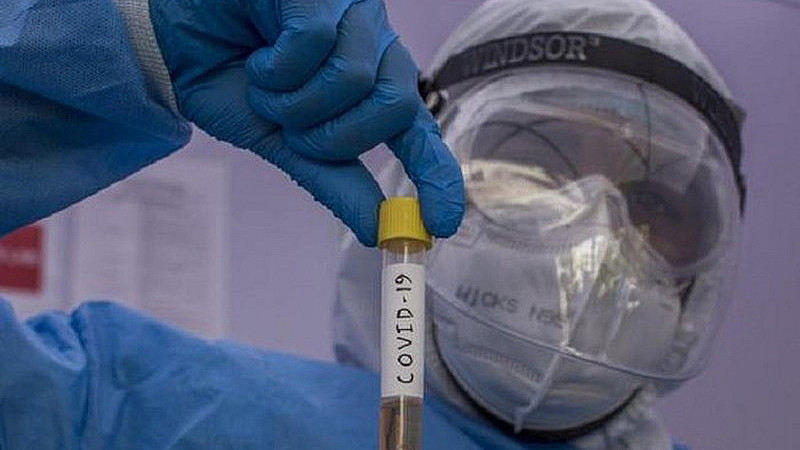 Sử dụng phương pháp rRT-PCR để tìm chất di truyền của virus SARS-CoV-2 Sử dụng phương pháp rRT-PCR để tìm chất di truyền của virus SARS-CoV-2