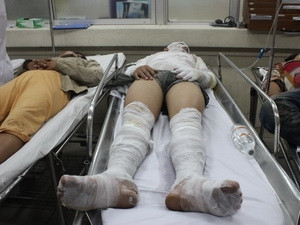 Đã xác định danh tính các nạn nhân vụ nổ khí gas ảnh 1