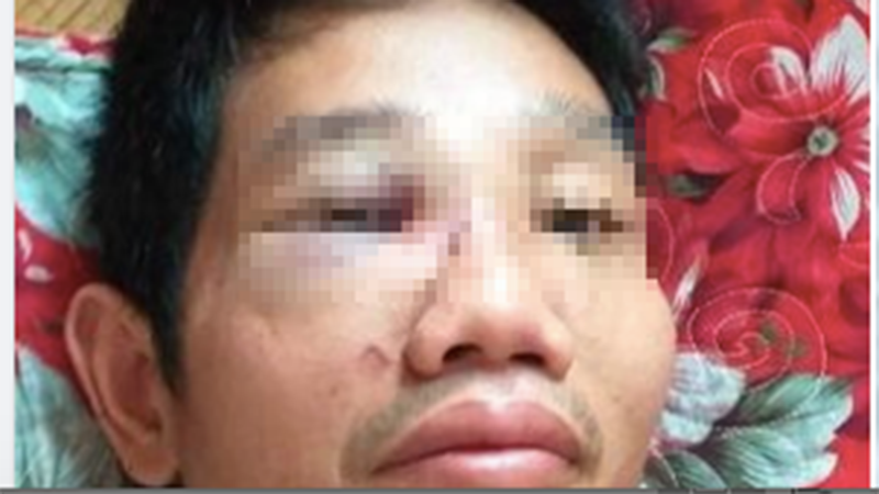 Ông Kiên sau vụ xô xát (Ảnh: Zing)