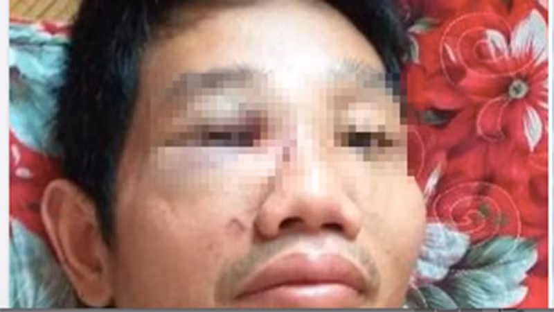 Ông Kiên sau vụ xô xát (Ảnh: Zing)