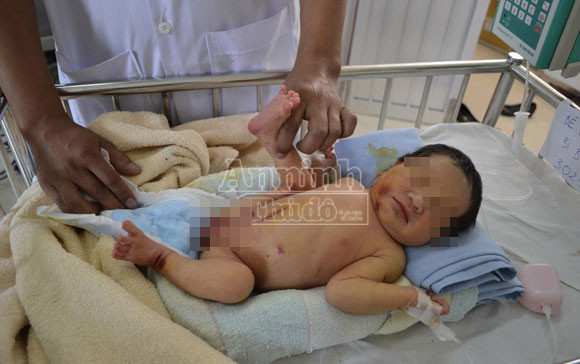 Bé gái 10 ngày tuổi bị bỏ rơi ở bụi tre, dòi, kiến bâu đầy người ảnh 1