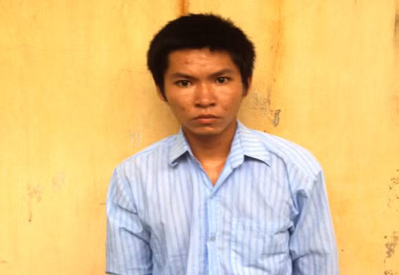 Chồng thuê người rạch mặt nhầm... vợ mình ảnh 2