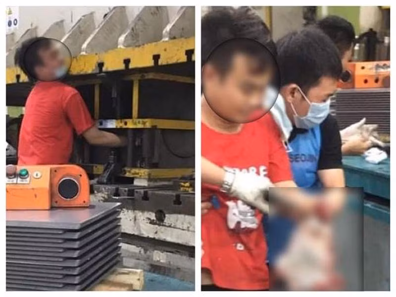 Một công nhân bị máy dập thép nghiền nát bàn tay