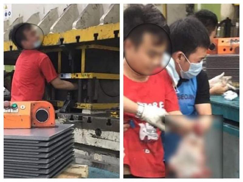 Một công nhân bị máy dập thép nghiền nát bàn tay Một công nhân bị máy dập thép nghiền nát bàn tay