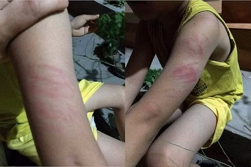 Dấu hiệu nào cho thấy con bạn đang bị bạo lực học đường? ảnh 2 Dấu hiệu nào cho thấy con bạn đang bị bạo lực học đường? ảnh 2