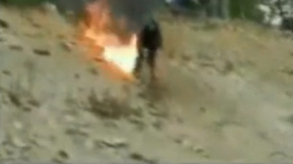 Nam thanh niêm suýt bị lửa thiêu cháy vì chơi trò quái gở ảnh 1