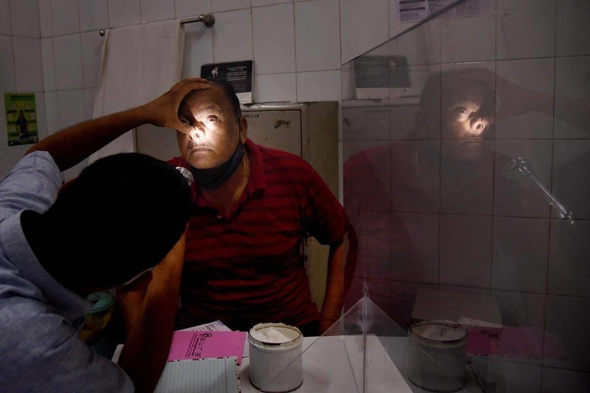 Ca bệnh nhiễm nấm vàng được ghi nhận khi Ấn Độ đang phải chống chọi với sự gia tăng các ca nhiễm nấm đen và nấm trắng ở bệnh nhân Covid-19 Ca bệnh nhiễm nấm vàng được ghi nhận khi Ấn Độ đang phải chống chọi với sự gia tăng các ca nhiễm nấm đen và nấm trắng ở bệnh nhân Covid-19