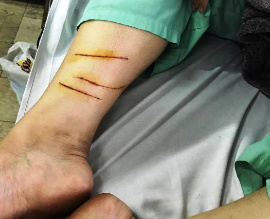 Điều tra vụ cô gái dẫn 20 giang hồ truy sát kinh hoàng 1 thiếu nữ 16 tuổi ảnh 3 Điều tra vụ cô gái dẫn 20 giang hồ truy sát kinh hoàng 1 thiếu nữ 16 tuổi ảnh 3