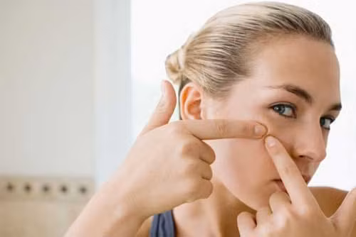 Những cách đơn giản để làm mờ sẹo ảnh 1