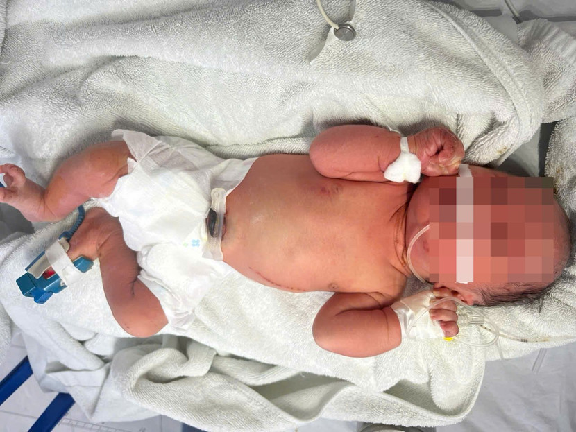 Trẻ sơ sinh bị bỏ rơi đã được bệnh viện điều trị, chăm sóc kịp thời Trẻ sơ sinh bị bỏ rơi đã được bệnh viện điều trị, chăm sóc kịp thời