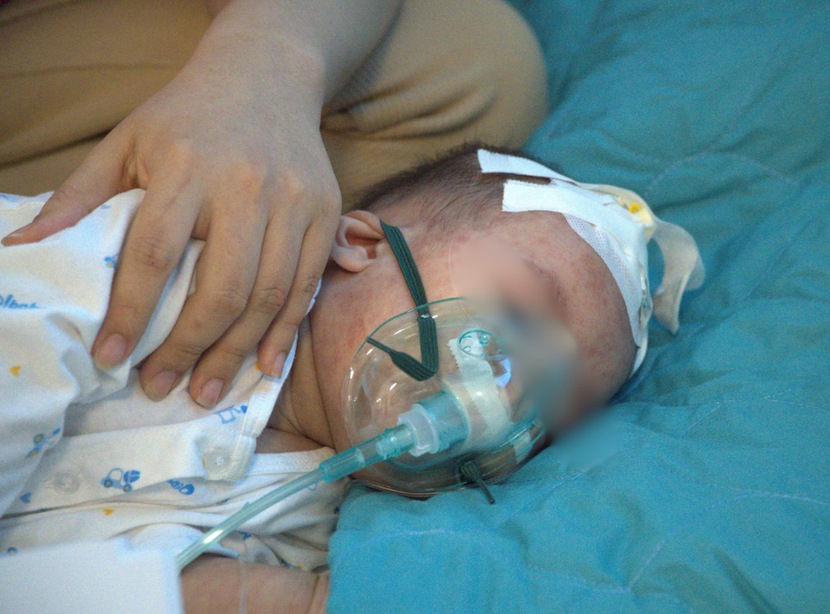 Điều trị trẻ em mắc sởi tại Hà Nội