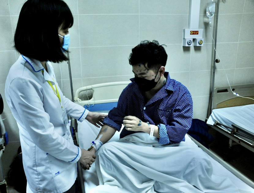 Điều trị bệnh nhân mắc thủy đậu tại Hà Nội