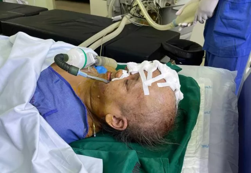 Sau ca phẫu thuật, bệnh nhân đã được "trả lại" khuôn mặt bình thường Sau ca phẫu thuật, bệnh nhân đã được "trả lại" khuôn mặt bình thường