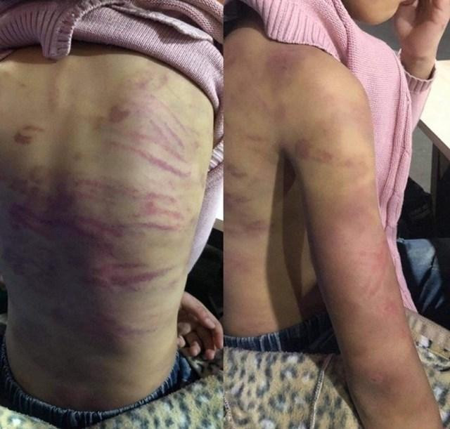 Cháu bé 12 tuổi bị người tình của mẹ hành hung, xâm hại Cháu bé 12 tuổi bị người tình của mẹ hành hung, xâm hại