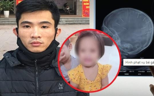 Bé gái bị người tình của mẹ đóng đinh vào đầu Bé gái bị người tình của mẹ đóng đinh vào đầu