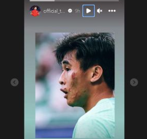 Bức ảnh mặt rớm máu được Dai Wai Tsun đăng lên trang mạng xã hội cá nhân sau trận