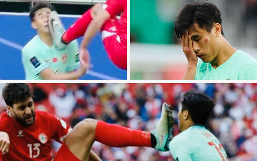 Dai Wai Tsun mặt rớm máu sau pha vào bóng của Khalil Khamis