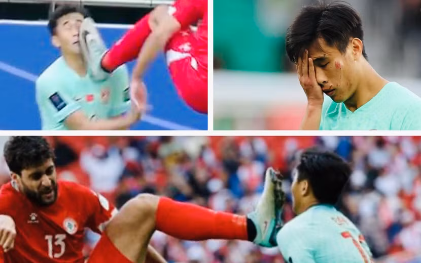 Dai Wai Tsun mặt rớm máu sau pha vào bóng của Khalil Khamis