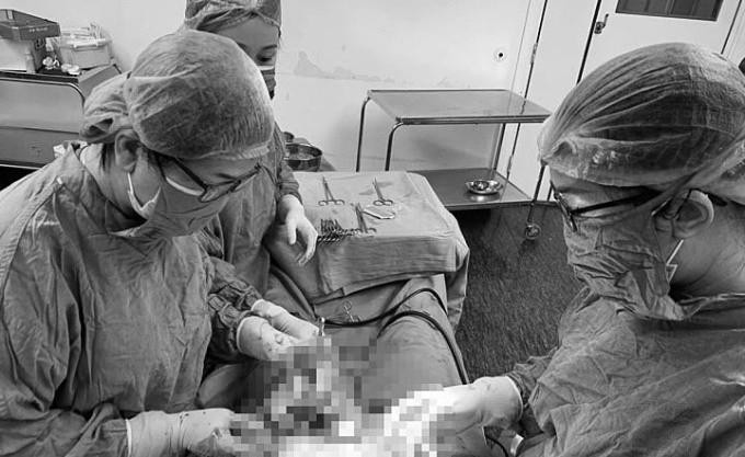 Các bác sĩ phẫu thuật lấy thai cho sản phụ Các bác sĩ phẫu thuật lấy thai cho sản phụ