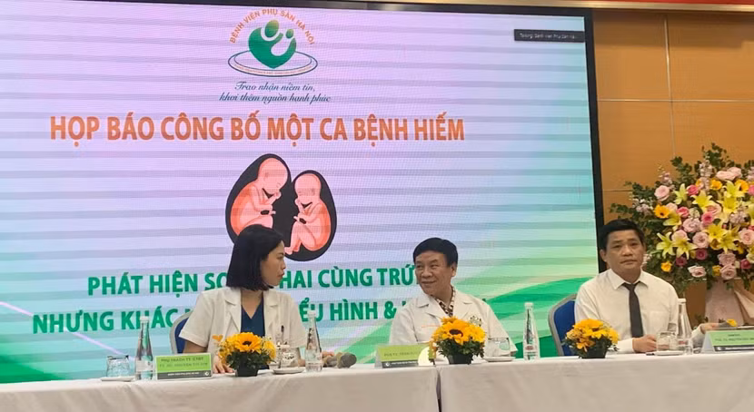 Bệnh viện Phụ sản Hà Nội công bố ca song thai hiếm gặp