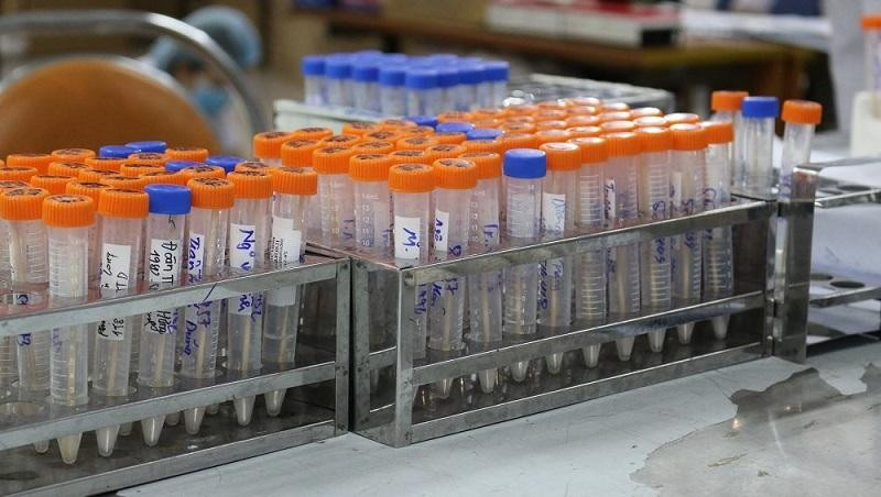 Trong ngày 21-8 Hà Nội phát hiện thêm 64 mẫu dương tính với SARS-CoV-2 (Ảnh minh họa)