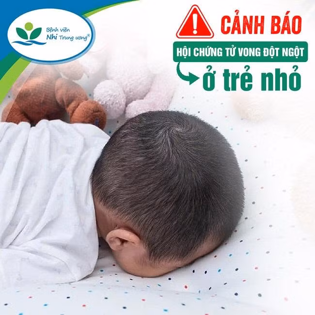 Cảnh báo hội chứng tử vong đột ngột ở trẻ nhỏ (Ảnh: Bệnh viện Nhi Trung ương)