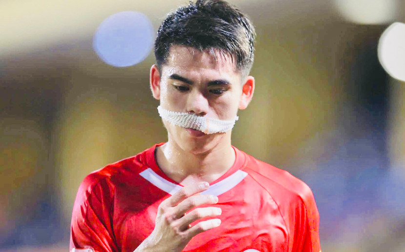 Khuất Văn Khang phải khâu 10 mũi vùng môi, song sẽ sớm thi đấu trở lại