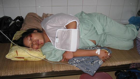 Chị Nguyễn Thị Huệ đang nằm bất động tại phòng cấp cứu bệnh viện Đa khoa huyện Chương Mỹ Chị Nguyễn Thị Huệ đang nằm bất động tại phòng cấp cứu bệnh viện Đa khoa huyện Chương Mỹ