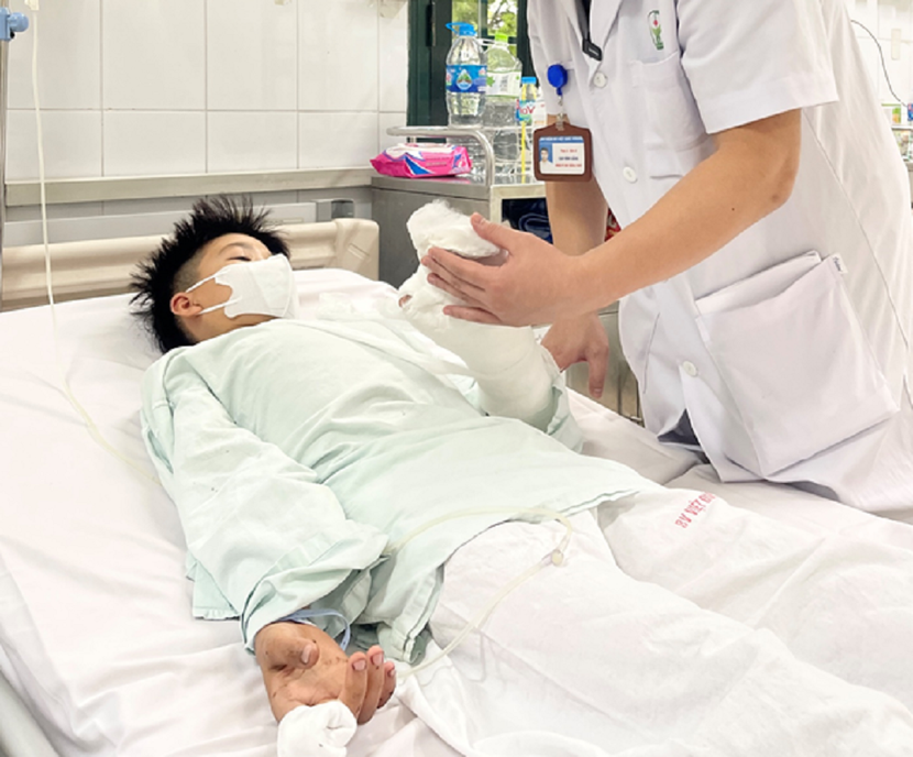 Một trẻ chấn thương nặng bàn tay do pháo tự chế Một trẻ chấn thương nặng bàn tay do pháo tự chế