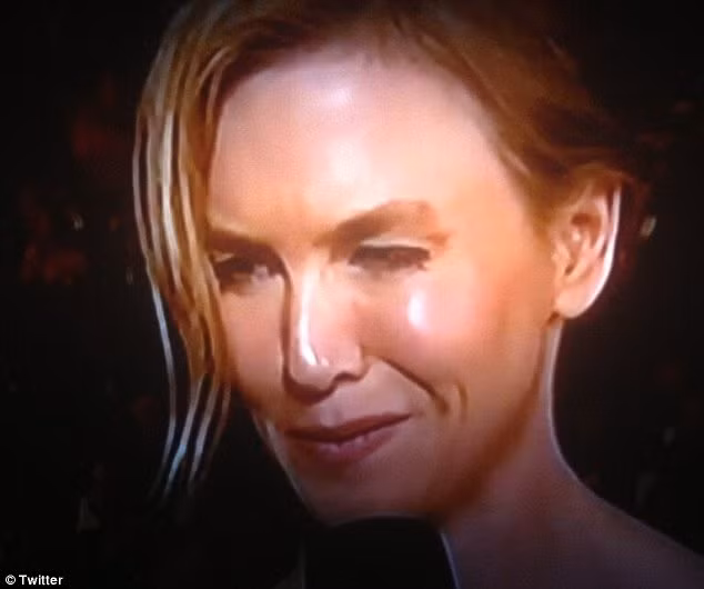 Nghi án Renee Zellweger lạm dụng botox ảnh 3