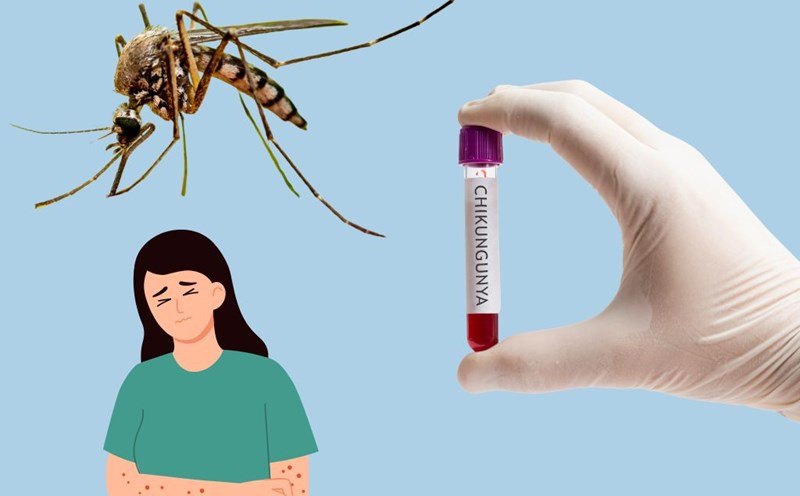 Bệnh Chikungunya đang lây lan ở nhiều nước
