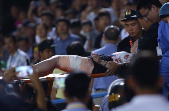 V-League 2019, một nữ cổ động viên trúng pháo sáng phải cấp cứu, còn người đốt quả pháo sáng - một cổ động viên Nam Định - bị tuyên phạt 4 năm tù V-League 2019, một nữ cổ động viên trúng pháo sáng phải cấp cứu, còn người đốt quả pháo sáng - một cổ động viên Nam Định - bị tuyên phạt 4 năm tù