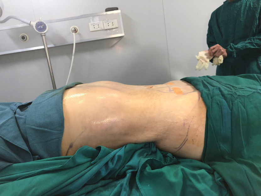 Bác sĩ khuyến cáo người dân khi có nhu cầu làm đẹp hãy chọn các cơ sở uy tín (Ảnh minh họa) Bác sĩ khuyến cáo người dân khi có nhu cầu làm đẹp hãy chọn các cơ sở uy tín (Ảnh minh họa)