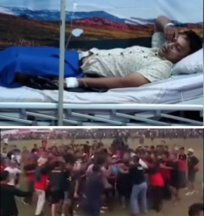 Trọng tài nhập viện sau khi bị hàng trăm cổ động viên, cầu thủ đội Putra Bakti lao vào hành hung