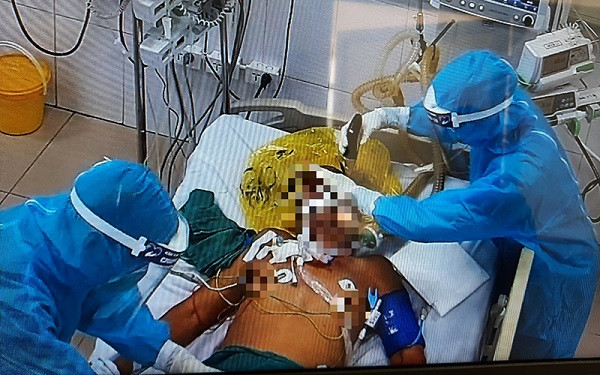 Điều trị bệnh nhân Covid-19 nặng tại BV Bệnh Nhiệt đới Trung ương