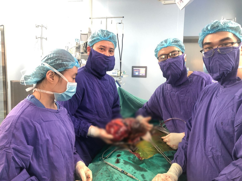 Kíp phẫu thuật Bệnh viện 108 cắt bỏ khối u thận phải khổng lồ 2,8kg của nữ bệnh nhân