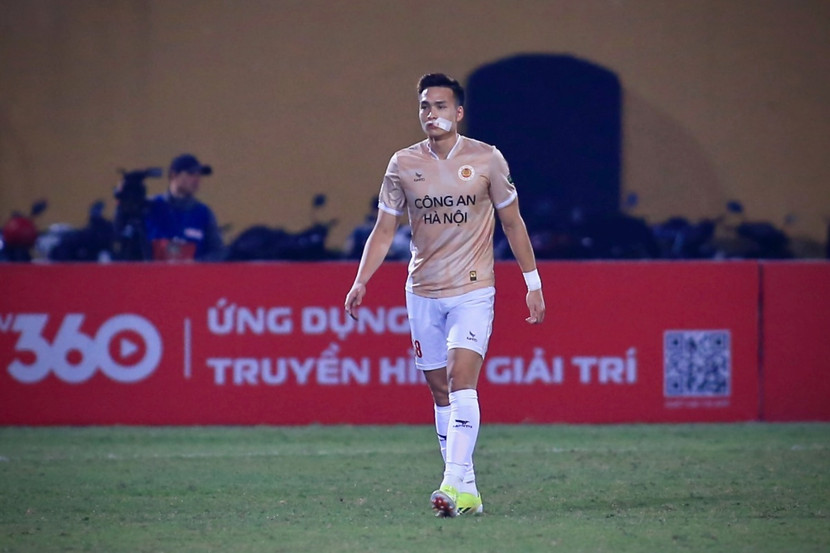 Bùi Hoàng Việt Anh phải chạy đua với thời gian để kịp đồng hành cùng tuyển Việt Nam tại hai lượt trận quan trọng với Indonesia ngày 21-3 và 26-3 Bùi Hoàng Việt Anh phải chạy đua với thời gian để kịp đồng hành cùng tuyển Việt Nam tại hai lượt trận quan trọng với Indonesia ngày 21-3 và 26-3