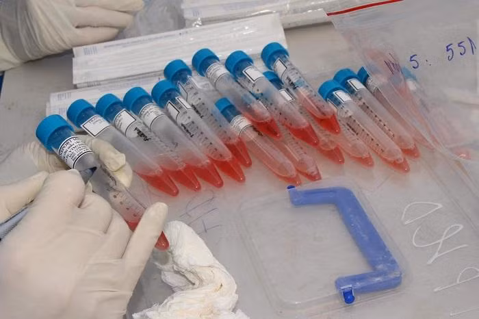 Lực lượng y tế lấy mẫu xét nghiệm Covid-19