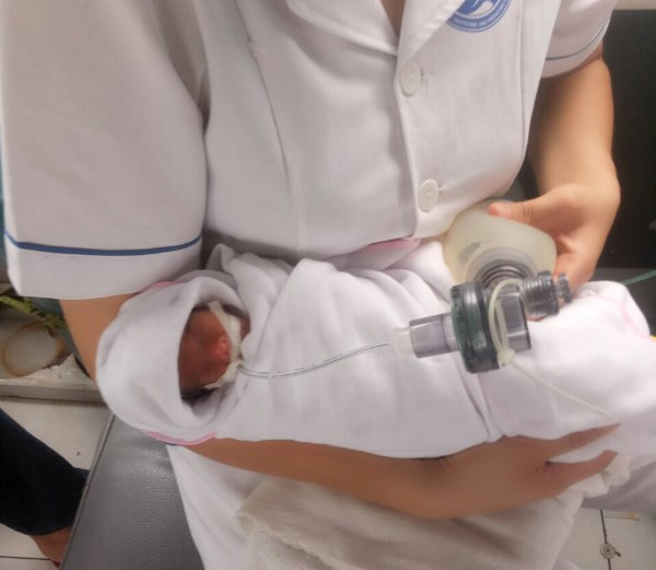 Bé Ốc chào đời ở tuần thai thứ 26, nặng chỉ 450g