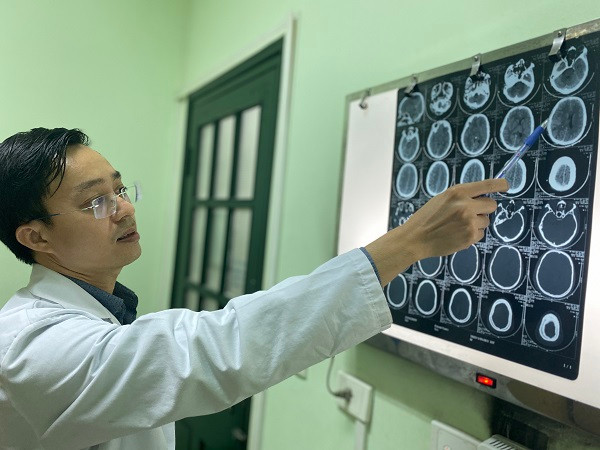 Hình ảnh chụp chiếu cho thấy bệnh nhân bị chấn thương sọ não