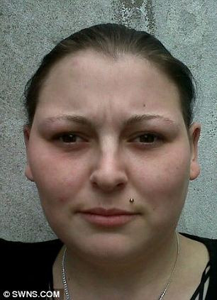 Tự nhuộm tóc khiến mắt bị mù và mặt bị biến dạng hoàn toàn ảnh 6