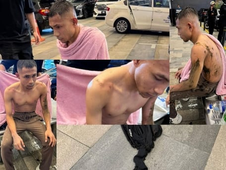 Faisal Halim bị tạt axit, sức khoẻ tạm ổn định sau 2 ca phẫu thuật liên tiếp Faisal Halim bị tạt axit, sức khoẻ tạm ổn định sau 2 ca phẫu thuật liên tiếp