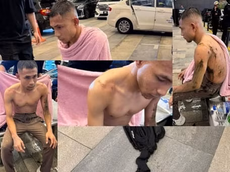 Faisal Halim bị tạt axit, sức khoẻ tạm ổn định sau 2 ca phẫu thuật liên tiếp