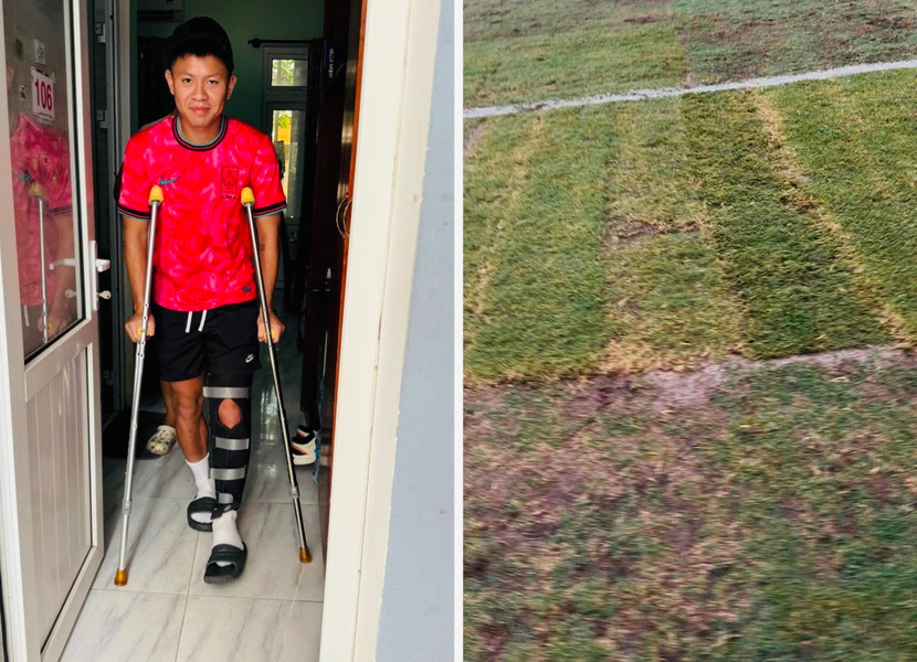 HLV Văn Sỹ Sơn chia sẻ hình ảnh mặt sân Mỹ Đình nham nhở và học trò Vũ Tiến Long chống nạng sau tình huống chấn thương dẫn đến đứt dây chằng chéo trước chân trái HLV Văn Sỹ Sơn chia sẻ hình ảnh mặt sân Mỹ Đình nham nhở và học trò Vũ Tiến Long chống nạng sau tình huống chấn thương dẫn đến đứt dây chằng chéo trước chân trái