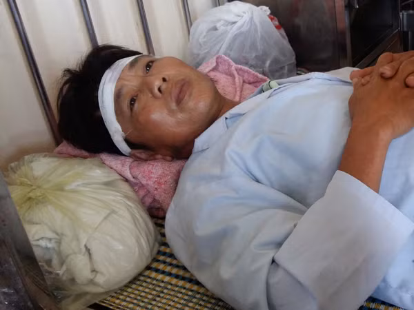 Nhắc nhở nhóm thanh niên bắt trộm cá, công an xã bị chém trọng thương ảnh 1