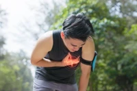 Dấu hiệu cảnh báo đột quỵ khi chơi thể thao