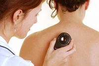 Những dấu hiệu ung thư dễ bị bỏ qua 